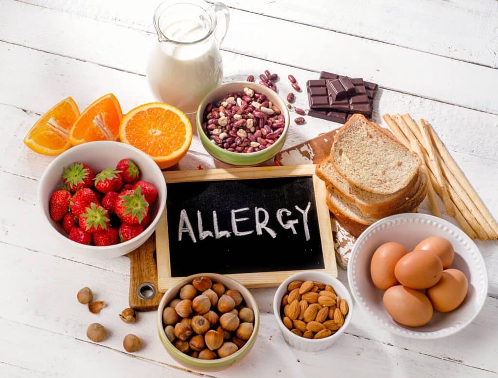 Food allergy triggers on table: milk, eggs, bread, nuts, strawberries, oranges, chocolate, beans, and Allergy sign.