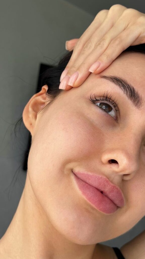 Close-up of a woman gently touching her forehead, highlighting clear skin and natural beauty.